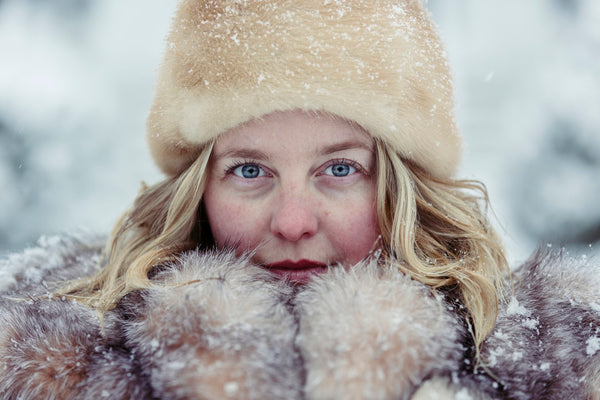 Best Winter Skincare Tips to Prepare Your Skin